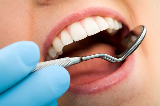 dental-insurance-gogoodscout